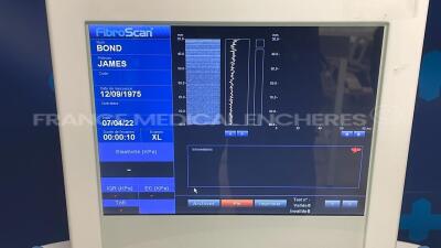 Echosens Fibroscanner FibroScan 502 - YOM 2007 w/ Echosens Probe XL plus - YOM 2012 and Echosens Probe M plus - YOM 2020 and keyboard (Powers up) - 10