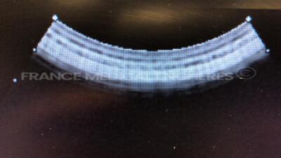 Hitachi Ultrasound EUB-5500 - YOM 2008 - S/W V06-04A - Options Software transfert DICOM - Software print image DICOM - DICOM software worklist - network interface w/ Hitachi Probe EUP-L54MA and Hitachi Probe EUP-C514 and Mitsubishi Printer P93 and Footswi - 15