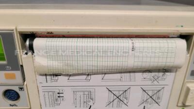 Lot of 2 Fœtal Monitors Series 50XM - YOM 1998/2001 - no power cables (Both power up) - 4