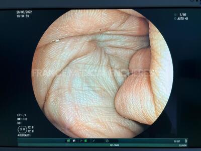 Fujinon Colonoscope EC-530WI - tested and functional - 8