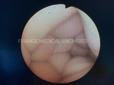 Olympus Bronchoscope BF-PE2 - Engineer's report : Optical system 3 black dots on image ,Angulation no fault found , Insertion tube leak to be repaired , Light transmission no fault found , Channels no fault found, Leak check no fault found - 4