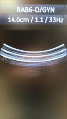 GE Ultrasound Voluson E6 BT12 - YOM 2011 - S/W 12.0.6 - 3 buttons are missing - Options - Advanced 4D - DICOM - SonoNT - Vocal II - Advanced VCI - Sono AVC - BT Activation w/ RAB6-D probe YOM 09/2016 - GE Footswitch FSU-3000G and Sony Digital Graphic Prin - 13