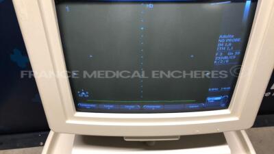 Philips Ultrasound Envisor C - YOM 2005 - S/W C.1.3 - Options high Q - doppler Iscan - TM anatomic - vascular - cardiac (Powers up) - 5