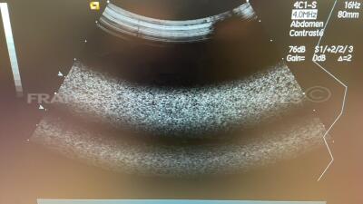 Acuson Ultrasound Sequoia C512 - YOM 2008 w/ Acuson Probe 4C1 and Acuson Probe 15L8w and Acuson Probe 6L3 and 3V2c (Powers up) - 6