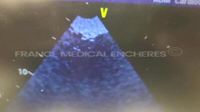 GE Ultrasound Vivid i - YOM 07/2009 - S/W 9.1.0 - Options TEE - vascular app - cardiac app - smart depth - ADVstress - DICOM modality - DICOM print - IMT - TSI - tissue velocity imaging and tissue tracking - w/ 3S-RS probe YOM 04/2012 (Powers up) - 7