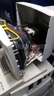 Esaote Ultrasound 7250 - To be repaired - 5