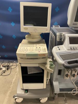 Lot of 1x Esaote Ultrasound Picus PRO 410636 and 1x Medison Ultrasound Accuvix XQ - EXP w/ Medison Probes C2-6IC and EC4-9IS (Both no power) - 3