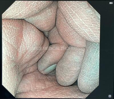 Olympus Gastroscope Evis Exera 3 GIF-XP190N - Engineer's report : Optical system no fault found ,Angulation no fault found , Insertion tube used and pinched , Light transmission no fault found , Channels leak in the operative channel , Leak no leak - 7