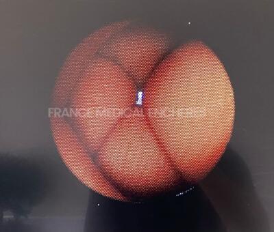 Pentax Fibroscope FCY-15RBS Engineer's report : Optical system 4 black pixels 3 grey pixels ,Angulation no fault found , Insertion tube no fault found , Light transmission no fault found , Channels no fault found, Leak no leak *g110906* - 12