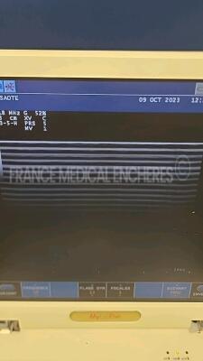 Esaote Ultrasound MyLabfive - YOM 2009 - S/W 1.01 - options clip - xview - mview - connector - doppler - CFM - w/ LA 435 probe - LA 523 probe see pictures of the tests (Powers up) *05-00740/37942/05550* - 11