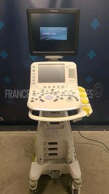 Aloka Ultrasound Arietta 60 - YOM 2015 w/ Sony Hybrid Graphic Printer UP-X898MD - wheels housing damaged see picture (Powers up) *20456941*