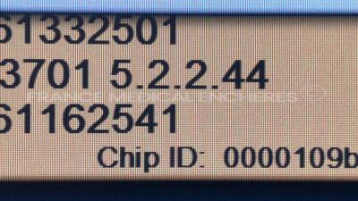 Philips Ultrasound iU22 - YOM 2007 - S/W 5.2.2.44 - Options - 3D Color - Basic 3D Imaging - QLab 3DQ GI - Clinical Option Abdomen - Netlink DICOM 3.0 - Clinical Option Contrast General Imaging - Language Option French - Smart Exam - Clinical Option GYN - - 23