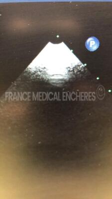 Philips Ultrasound IE33 - YOM 07/2008 - S/W 5.2.2.44 - Options TMQ advanced - Clinical option adult cardiology - Acquisition Protocol (Stress echo) - Netlink Dicom 3.0 - Clinical option compact adapter capability - Language option french - IMT - ROI tools - 26