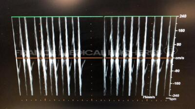 Philips Ultrasound IE33 - YOM 07/2008 - S/W 5.2.2.44 - Options TMQ advanced - Clinical option adult cardiology - Acquisition Protocol (Stress echo) - Netlink Dicom 3.0 - Clinical option compact adapter capability - Language option french - IMT - ROI tools - 32