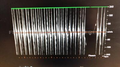 Philips Ultrasound IE33 - YOM 12/2005 - S/W 5.2.1.245 - Options 2DQ - Clinical Option Adult Cardiology - Acquisition Protocol (Stress Echo) - Netlink DICOM 3.0 - Language Option French - diagnostic error Code 503 w/ Philips Probe L11-3 and Philips Transdu - 24