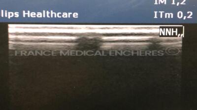 Philips Ultrasound CX50 - YOM 11/2010 - S/W 2.0.3 - Options Acute care - DICOM network -3D manual - Integration mode -Physical - SonoCT - TDI w/ Philips Probe L12-3 and Philips Probe C5-1 and Philips Cart CX - YOM 2010 ( Powers up) - 9