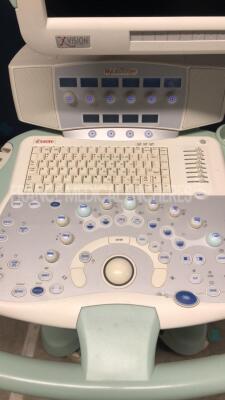 Esaote Ultrasound Mylab 70 X Vision - YOM 2010 - S/W 6.10 - options X view - TP view - autogain - M view - w/ LA 435 probe - LA 523 10 -5 probe (Powers up) - 4