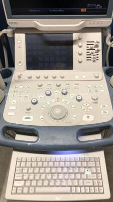 Toshiba Ultrasound SSA-790A Aplio XG - YOM 03/2009 w/ Toshiba Probe PLT-604AT and Toshiba Probe PVT-375BT - YOM 2012 and Toshiba Probe PLT-1204AT and Toshiba Probe PST-25BT - YOM 2009 and Toshiba Probe PVT-661VT - YOM 2009 (Powers up) - 4