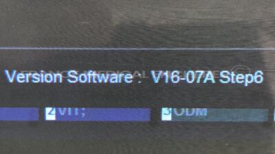 Hitachi Ultrasound EUB-8500 - YOM 2004 - S/W V16-07A - options software transfert DICOM - software impression image DICOM - DICOM software worklist -w/ EUP- C715 probe - EUP-L52 probe - EUP-L65 probe - EUP-C532 probe EUP-S50A (Powers up) - 5