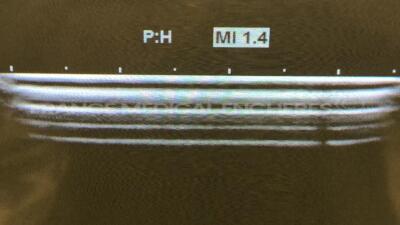 Hitachi Ultrasound EUB-8500 - YOM 2004 - S/W V16-07A - options software transfert DICOM - software impression image DICOM - DICOM software worklist -w/ EUP- C715 probe - EUP-L52 probe - EUP-L65 probe - EUP-C532 probe EUP-S50A (Powers up) - 12