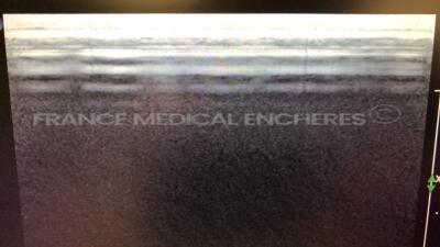 Philips Ultrasound iU22 - YOM 2006 - S/W 5.2.2.44 - Options - Basic 3D Imaging - Clinical Option Abdomen - Clinical Option Adult Cardiology - Netlink DICOM 3.0 - Clinical Option Contrast General Imaging - Language Option French - Smart Exam - Clinical Opt - 15